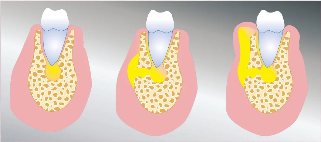 флюс - изображение 4