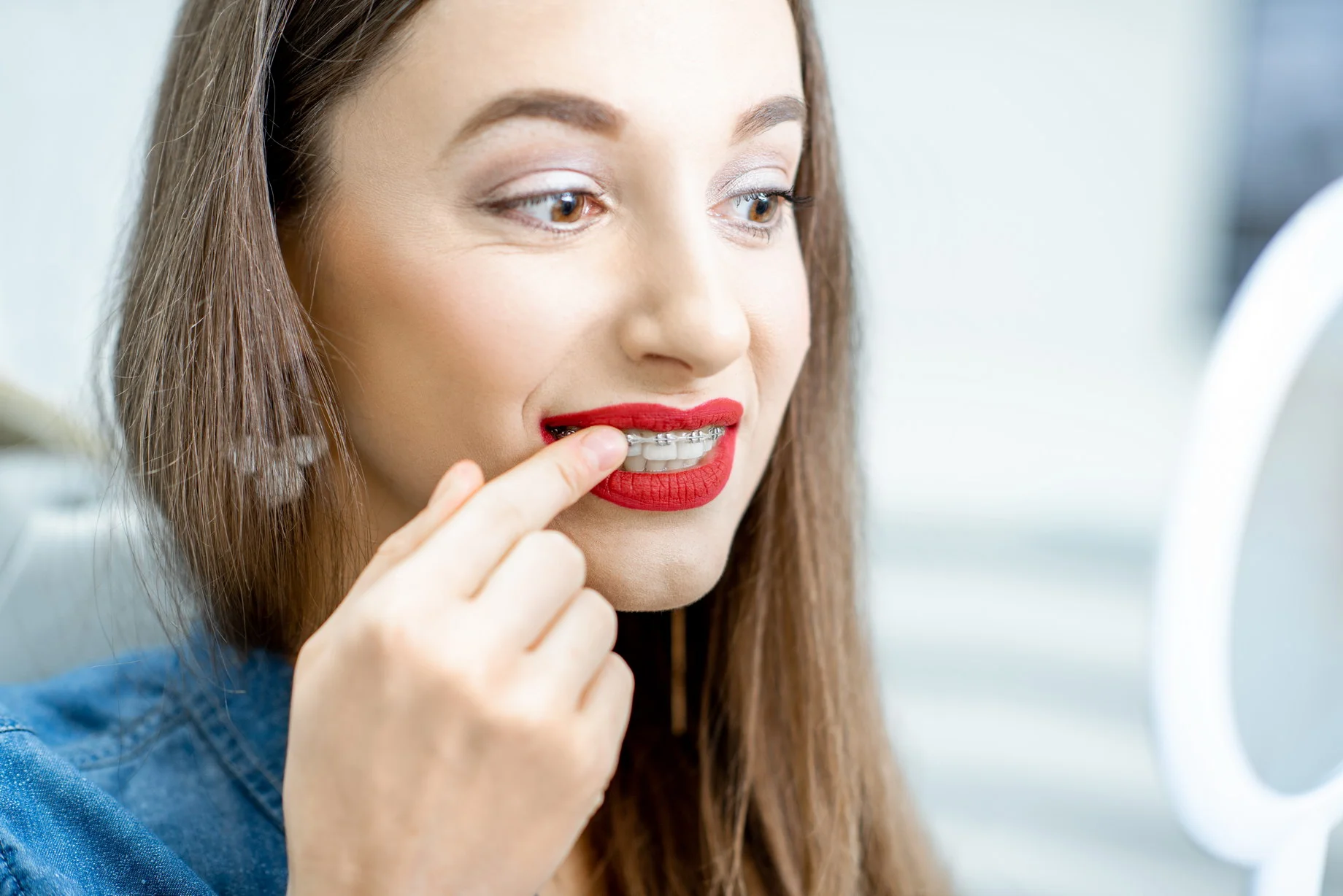 Лигатурные и безлигатурные брекеты