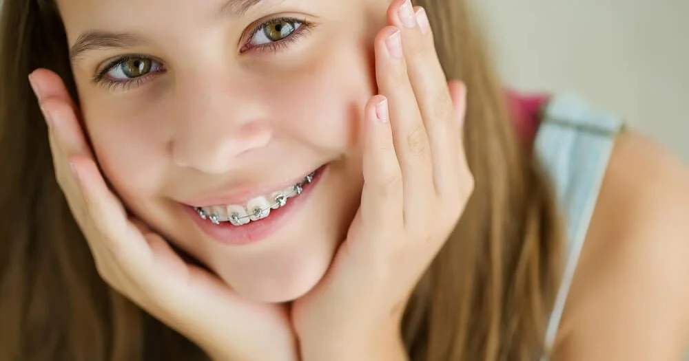 брекеты для подростков
