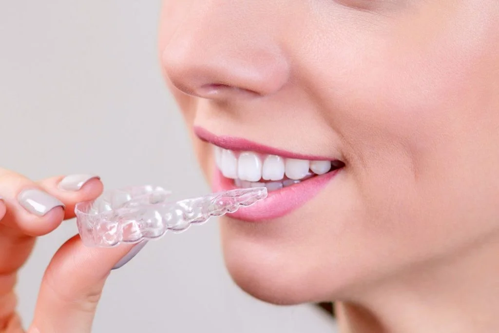 Выровнять кривые зубы без брекетов