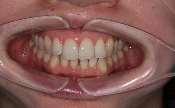 Лечение на Star Smile