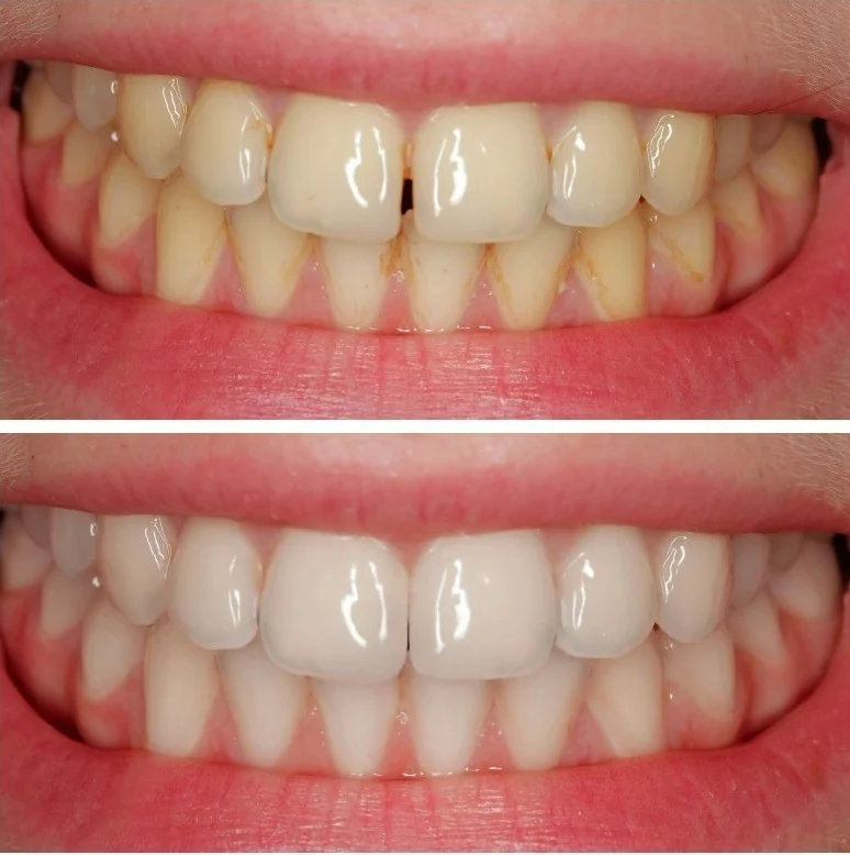 лечение художественной коррекцией