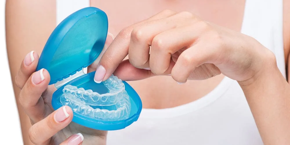 исправление прикуса без брекетов