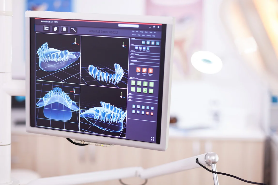 Композитная реставрация зубов