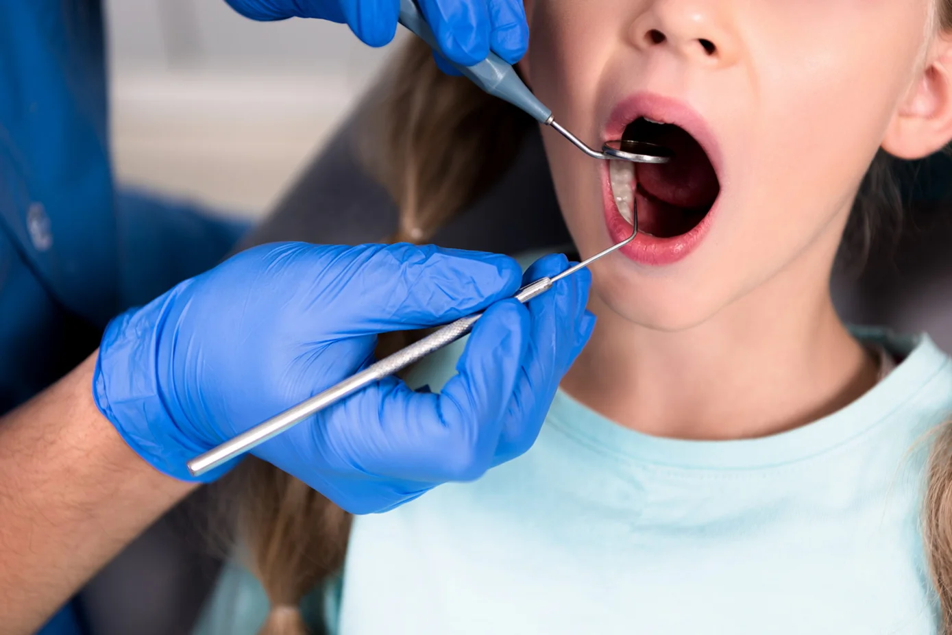 Удаление кисты зуба