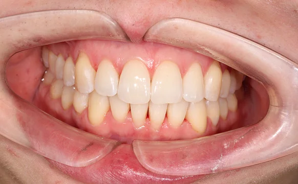 Лечение на Star Smile