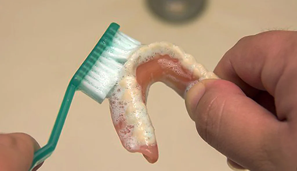 уход за иммедиат протезом фото