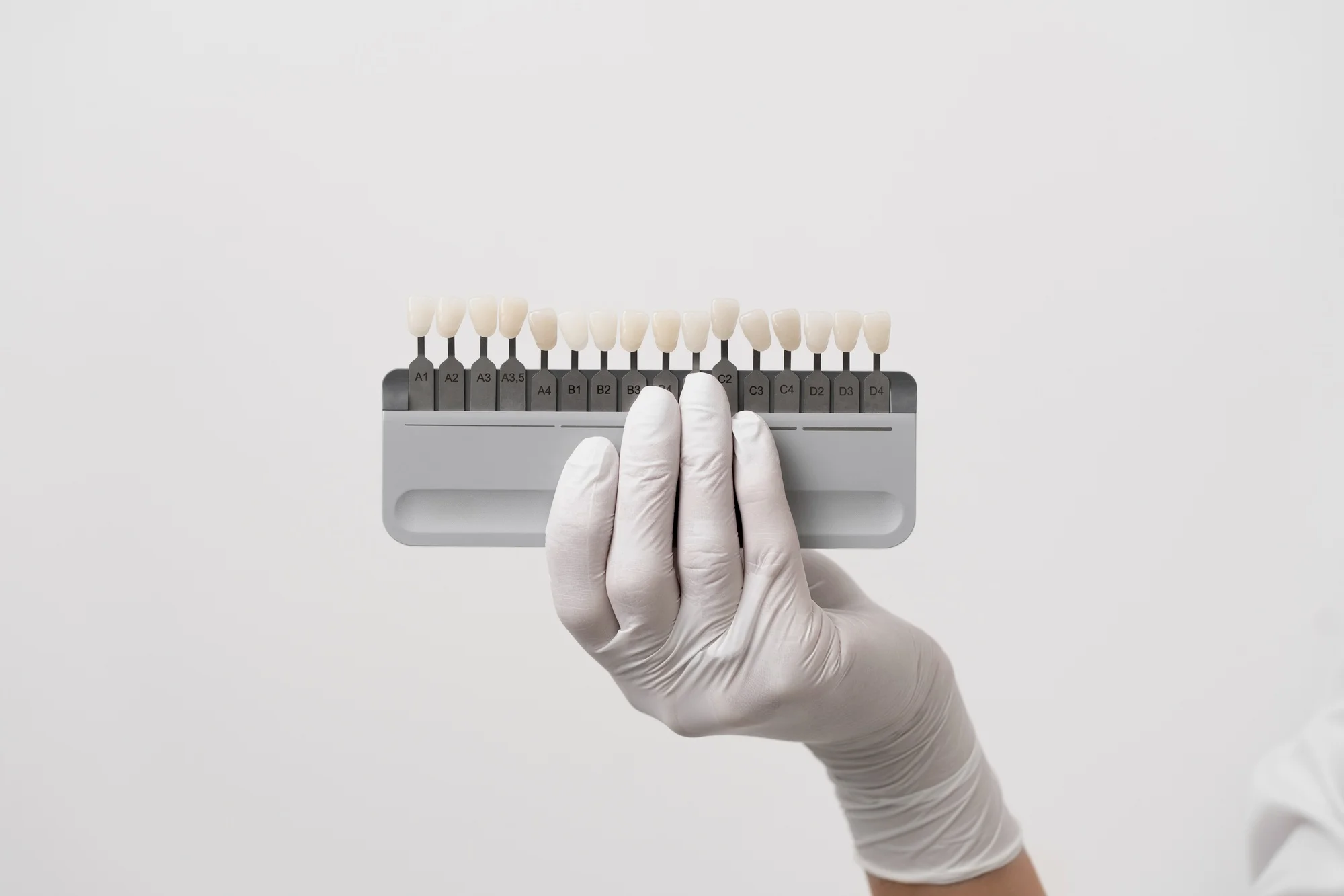 Как ставят виниры