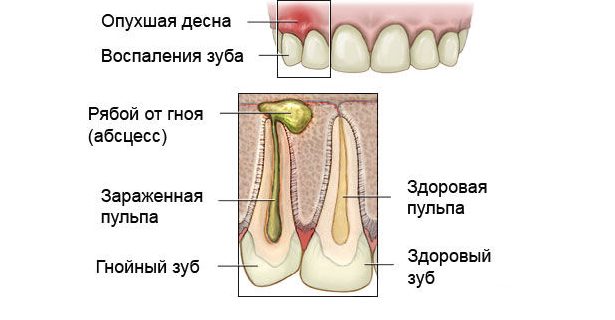 флюс - изображение 1